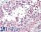 Solute Carrier Family 3 Member 2 antibody, LS-B3177, Lifespan Biosciences, Immunohistochemistry paraffin image 