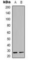 MOB Kinase Activator 3C antibody, orb318785, Biorbyt, Western Blot image 