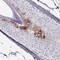 Keratin 84 antibody, HPA039714, Atlas Antibodies, Immunohistochemistry paraffin image 