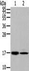 Trafficking Regulator Of GLUT4 (SLC2A4) 1 antibody, PA5-51266, Invitrogen Antibodies, Western Blot image 