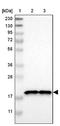 NADH:Ubiquinone Oxidoreductase Subunit B7 antibody, NBP1-88938, Novus Biologicals, Western Blot image 