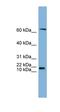 GM2 Ganglioside Activator antibody, orb330460, Biorbyt, Western Blot image 