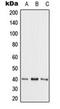 Adenosine Kinase antibody, orb215999, Biorbyt, Western Blot image 