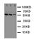 Kallikrein Related Peptidase 2 antibody, orb76140, Biorbyt, Western Blot image 