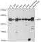 Ubiquitin Specific Peptidase 5 antibody, GTX64671, GeneTex, Western Blot image 