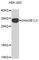 Deoxyribonuclease 1 Like 3 antibody, A3832, ABclonal Technology, Western Blot image 