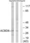 Acyl-CoA Binding Domain Containing 6 antibody, abx014146, Abbexa, Western Blot image 