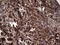 RSPO3 antibody, TA804633, Origene, Immunohistochemistry paraffin image 