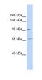 N-Acetyltransferase 2 antibody, orb330371, Biorbyt, Western Blot image 