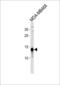 TPD52 Like 3 antibody, LS-C203911, Lifespan Biosciences, Western Blot image 