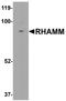 Hyaluronan mediated motility receptor antibody, A05056, Boster Biological Technology, Western Blot image 