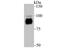 Protein Kinase D2 antibody, NBP2-75629, Novus Biologicals, Western Blot image 