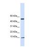 ATP Synthase Inhibitory Factor Subunit 1 antibody, NBP1-79284, Novus Biologicals, Western Blot image 