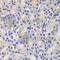 Glutathione S-Transferase Pi 1 antibody, A5691, ABclonal Technology, Immunohistochemistry paraffin image 