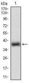 Receptor Tyrosine Kinase Like Orphan Receptor 2 antibody, NBP2-37263, Novus Biologicals, Western Blot image 