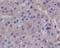Matrix Metallopeptidase 1 antibody, M00733, Boster Biological Technology, Immunohistochemistry paraffin image 
