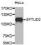 Elongation Factor Tu GTP Binding Domain Containing 2 antibody, MBS129280, MyBioSource, Western Blot image 