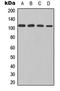 Nuclear Factor Kappa B Subunit 1 antibody, LS-C358828, Lifespan Biosciences, Western Blot image 