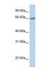 Transmembrane 9 Superfamily Member 1 antibody, NBP1-62531, Novus Biologicals, Western Blot image 