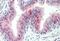 Zinc Finger DHHC-Type Containing 13 antibody, GTX89603, GeneTex, Immunohistochemistry paraffin image 