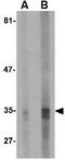 Endonuclease G antibody, GTX84987, GeneTex, Western Blot image 