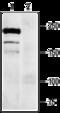 Sodium Voltage-Gated Channel Alpha Subunit 9 antibody, GTX54800, GeneTex, Western Blot image 