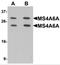 Membrane Spanning 4-Domains A6A antibody, NBP2-82106, Novus Biologicals, Western Blot image 