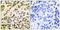 Fli-1 Proto-Oncogene, ETS Transcription Factor antibody, LS-C118452, Lifespan Biosciences, Immunohistochemistry paraffin image 