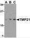 Transmembrane P24 Trafficking Protein 10 antibody, 3999, ProSci, Western Blot image 