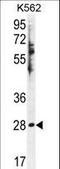 Hydroxysteroid 11-Beta Dehydrogenase 1 Like antibody, LS-C203670, Lifespan Biosciences, Western Blot image 