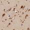 Toll Like Receptor 7 antibody, NB100-56588, Novus Biologicals, Immunohistochemistry frozen image 