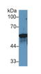 Keratin 6A antibody, LS-C299757, Lifespan Biosciences, Western Blot image 