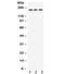 Platelet Derived Growth Factor Receptor Alpha antibody, R31979, NSJ Bioreagents, Western Blot image 