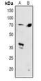 SMAD Family Member 4 antibody, LS-C760933, Lifespan Biosciences, Western Blot image 