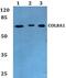 Collagen Type VIII Alpha 1 Chain antibody, PA5-37109, Invitrogen Antibodies, Western Blot image 