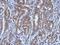 Ubiquitination Factor E4A antibody, PA5-29197, Invitrogen Antibodies, Immunohistochemistry paraffin image 