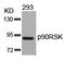 Ribosomal Protein S6 Kinase A1 antibody, A01058-2, Boster Biological Technology, Western Blot image 