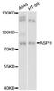 Aspartate Beta-Hydroxylase antibody, LS-C748217, Lifespan Biosciences, Western Blot image 
