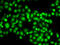 SET Binding Protein 1 antibody, 22-788, ProSci, Immunofluorescence image 