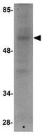 Ring Finger Protein 168 antibody, GTX85018, GeneTex, Western Blot image 