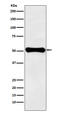 Glutamate Dehydrogenase 1 antibody, M01866, Boster Biological Technology, Western Blot image 