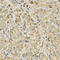 Fc Fragment Of IgE Receptor Ia antibody, LS-C335175, Lifespan Biosciences, Immunohistochemistry paraffin image 