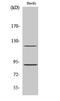 Progesterone Receptor antibody, A00541S190-1, Boster Biological Technology, Western Blot image 