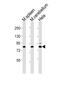 SUZ12 Polycomb Repressive Complex 2 Subunit antibody, M00583-2, Boster Biological Technology, Western Blot image 