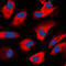 Protein Kinase C Zeta antibody, LS-C354069, Lifespan Biosciences, Immunofluorescence image 