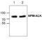 ALK Receptor Tyrosine Kinase antibody, GTX59665, GeneTex, Western Blot image 