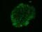 Keratan sulfate antigen TRA1-60 antibody, NB100-730, Novus Biologicals, Immunocytochemistry image 