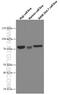 RAS Guanyl Releasing Protein 3 antibody, 66650-1-Ig, Proteintech Group, Western Blot image 