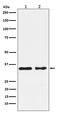 Casein Kinase 1 Alpha 1 antibody, M07171-1, Boster Biological Technology, Western Blot image 