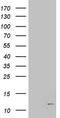 Beta-2-Microglobulin antibody, TA803617, Origene, Western Blot image 